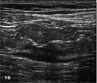 ADK colon-2 ADK colon-2