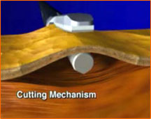 Harmonic Scalpel aplicate pe tesut