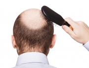 caderea parului