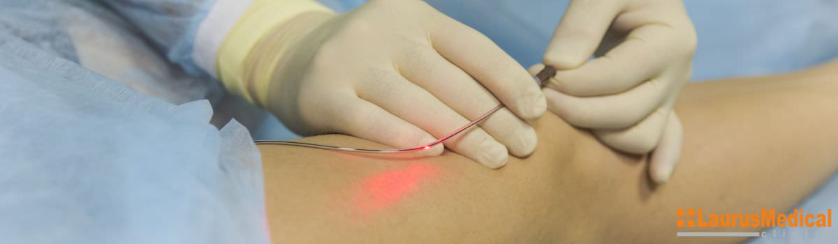 Terapia cu laser – o soluţie avantajoasă în cazul bolii varicoase