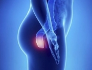 tromboza hemoroidala