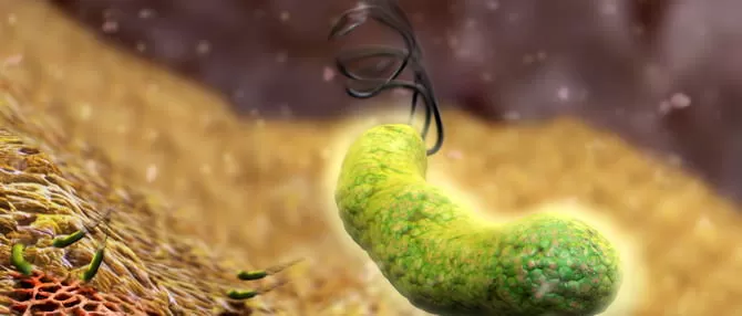 Helicobacter Pylori si Cancerul Gastric